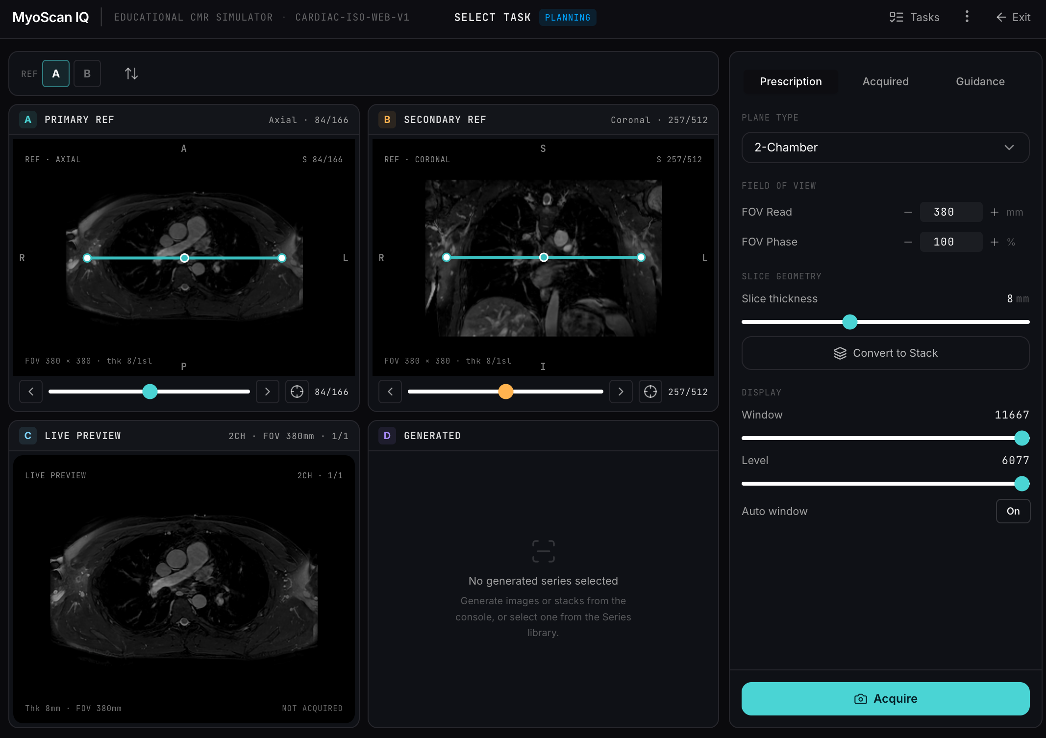 MyoScan IQ slice planning simulator